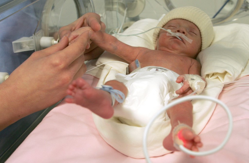 La mortalit&eacute; infantile au plus haut en France 